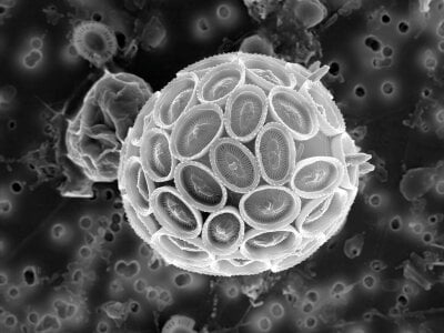 Mikroskopbilde av alge som ser ut som rund ball med mønster