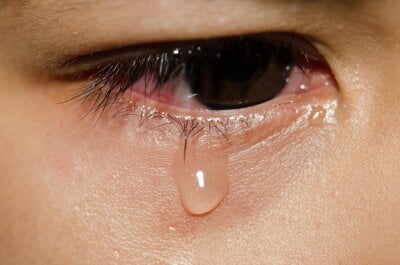 Nærbilde av et øye med tårer